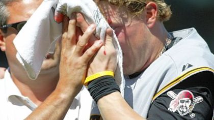 Pirates outfielder Nate McLouth is helped off the field after diving for a double by Giants' Pablo Sandoval in the fourth inning. He needed six stitches to close the gash.