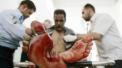 BAGHDAD -- Medics care for  a man wounded in a car bomb explosion, Oct. 27. A bomb placed under a car exploded in central Baghdad, killing 2 civilians and wounding 7 others, the police said.