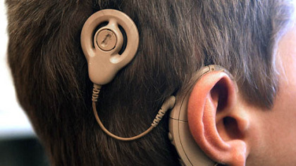 A youngster with cochlear implant, a dramatic advance for hearing-impaired children, visits with an audiologist